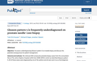 Gleason pattern 5 is frequently underdiagnosed on prostate needle-core biopsy