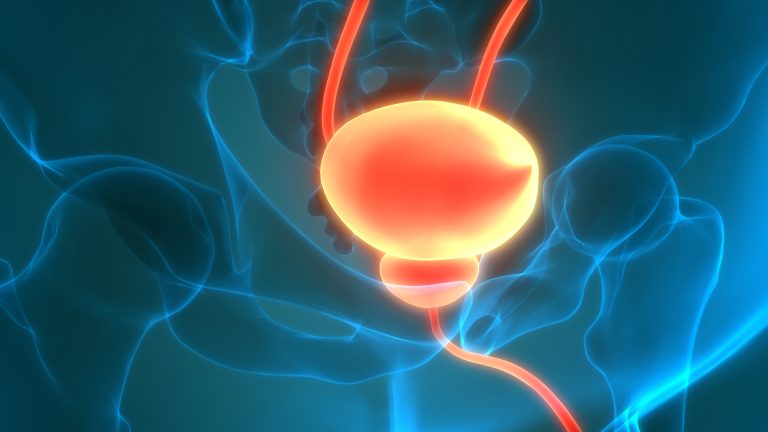 Frequency/Overactive Bladder (OAB) - Advanced Urology Centers of New York